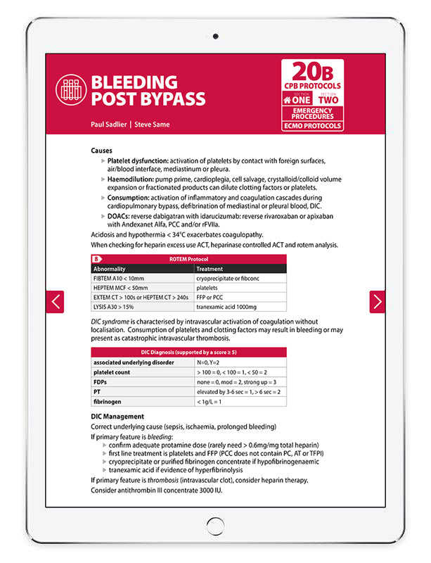 The PCM eBook